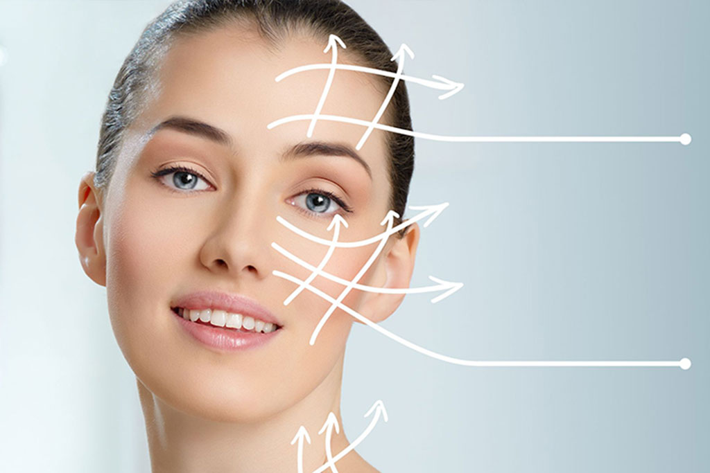 Long-lasting facelift to reduce expression lines