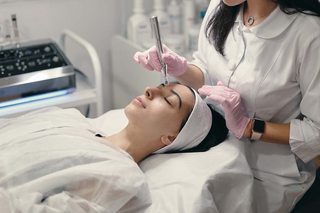 Microneedling Un tratamiento ideal para la reducción de cicatrices y arrugas