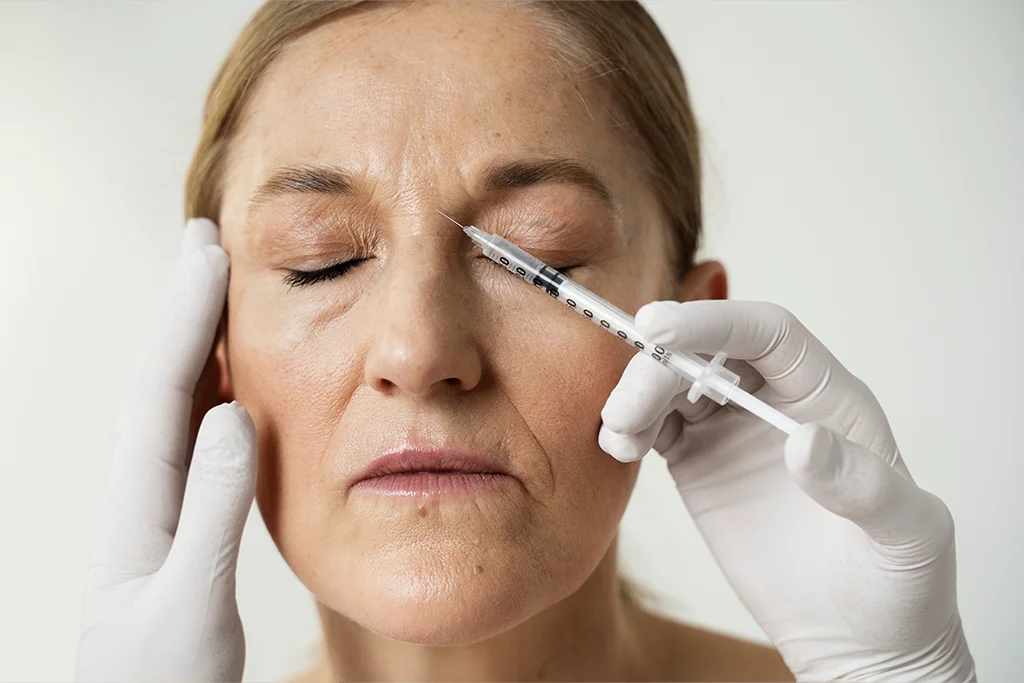 Cuándo es el momento ideal para considerar aplicarse Botox